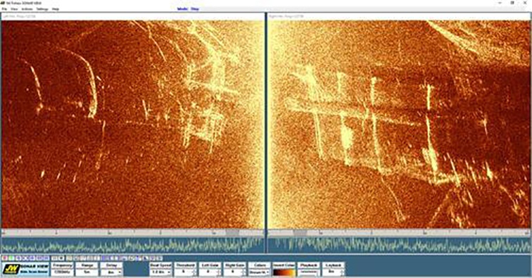 美女的隐藏部位是什么图片