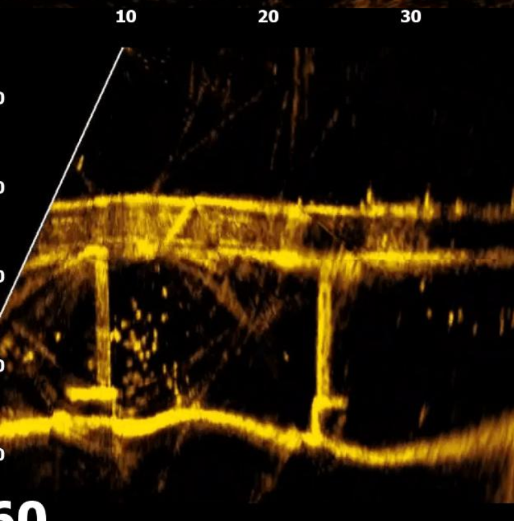 美女的隐藏部位是什么图片
